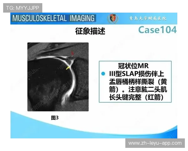 凯斯勒左肩关节盂唇撕裂,本赛季报销!内线低迷让球队头疼 凯斯勒左肩关节盂唇撕裂,本赛季报销!内线低迷让球队头疼